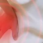 腰痛